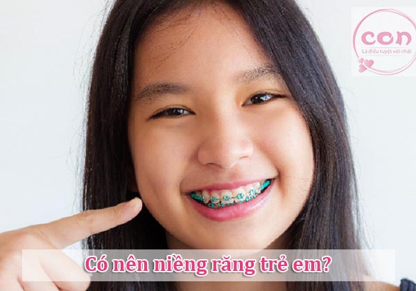 Có nên niềng răng trẻ em
