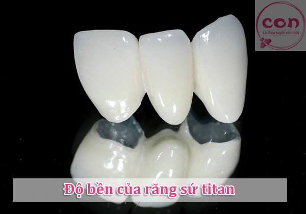 Độ bền của răng sứ titan