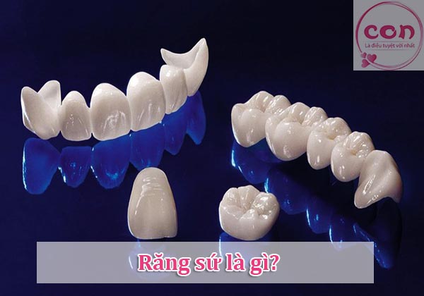 Răng sứ là gì_Sotayandam