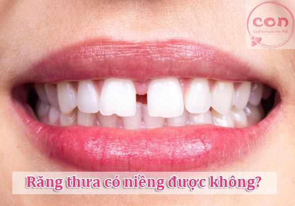 Răng thưa có niềng được không