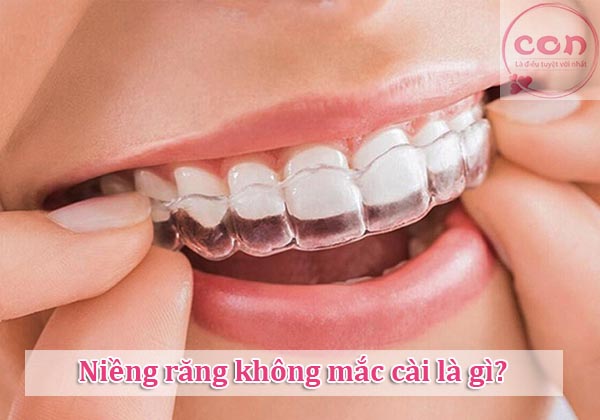 Niềng răng không mắc cài là gì_Sotayandam