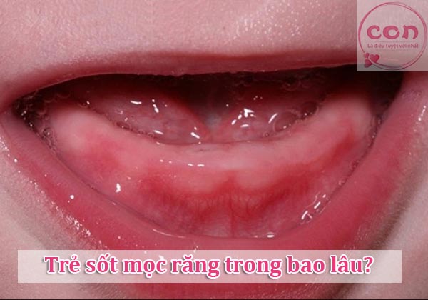 Trẻ sốt mọc răng trong bao lâu