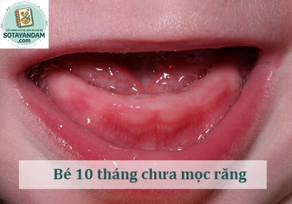 Bé 10 tháng chưa mọc răng có sao không