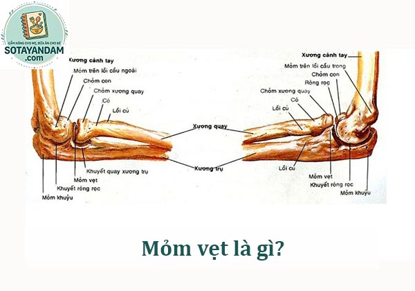 Mỏm vẹt là gì