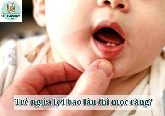 Trẻ ngứa lợi bao lâu thì mọc răng