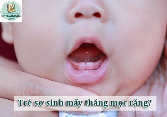 Trẻ sơ sinh mấy tháng mọc răng