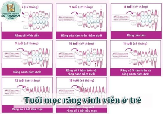 Tuổi mọc răng vĩnh viễn ở trẻ